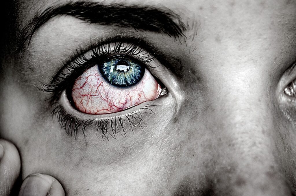 Why Do My Eyes Hurt