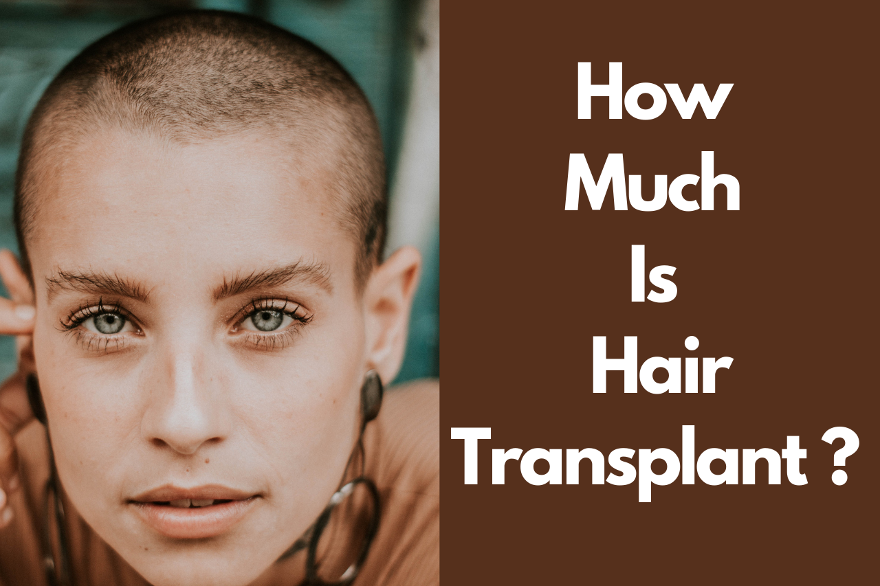 How Much Is Hair Transplant? Is It worth Hair Transplant?