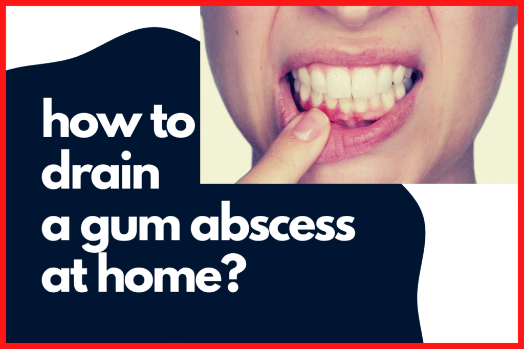 how to drain a gum abscess at home