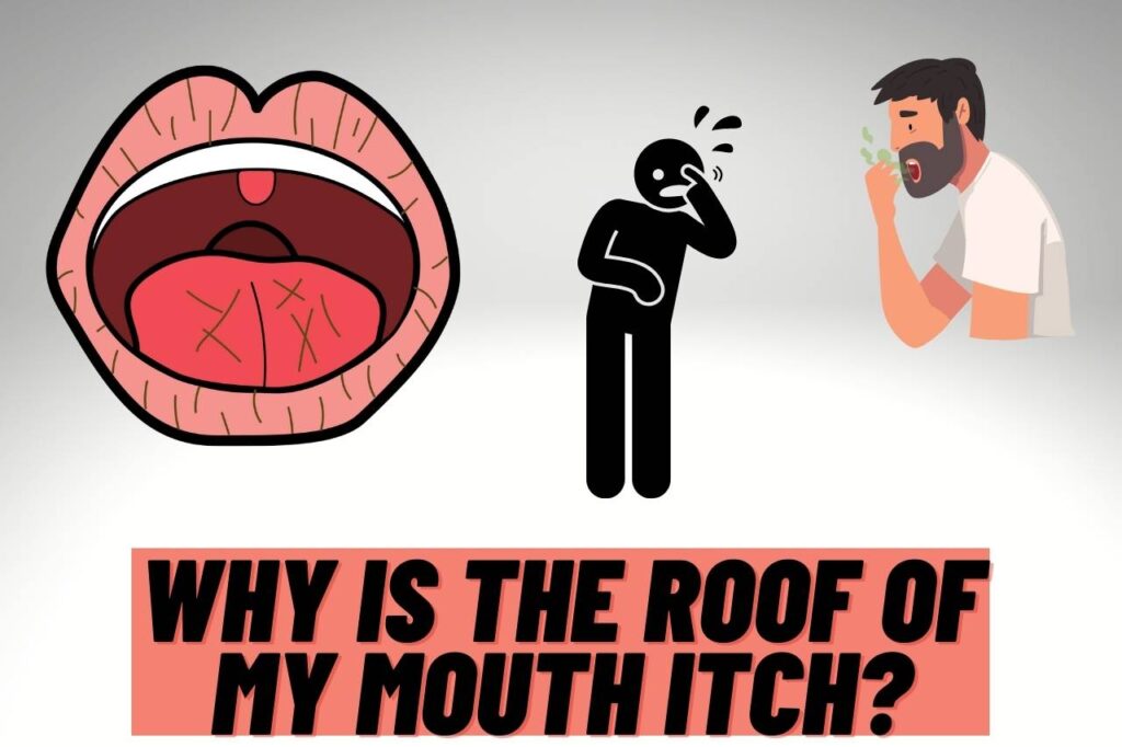 why is the roof of my mouth itch