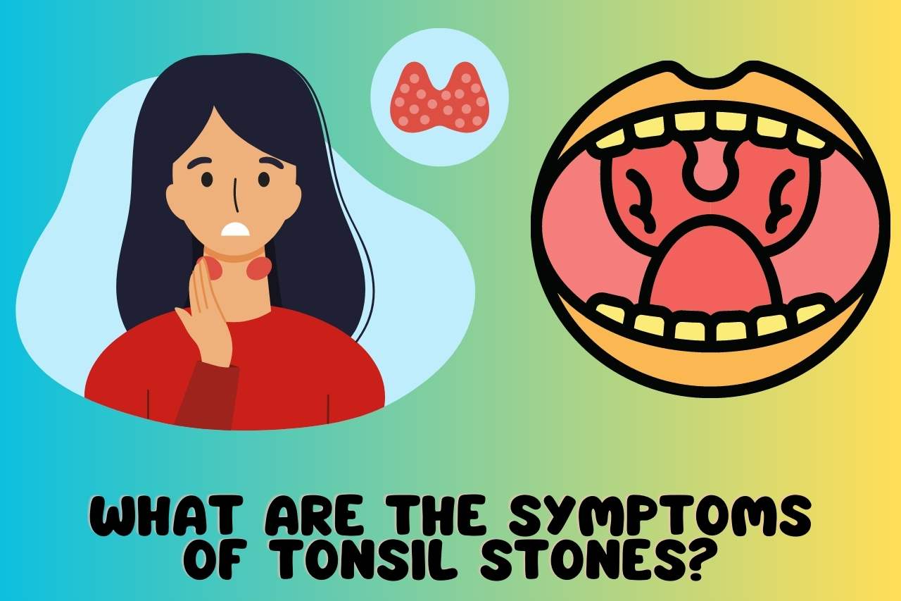 What are the Symptoms of Tonsil Stones